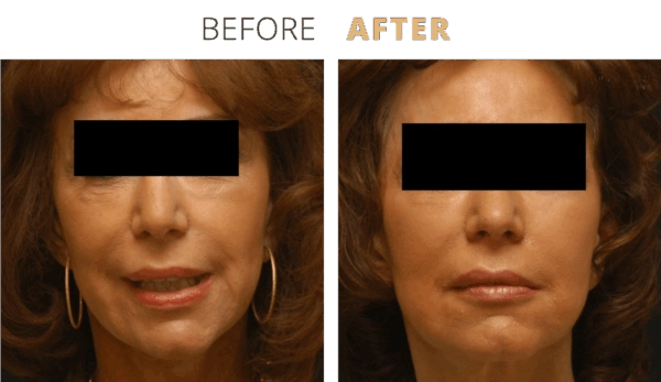 admin-ajax (4) - Edited