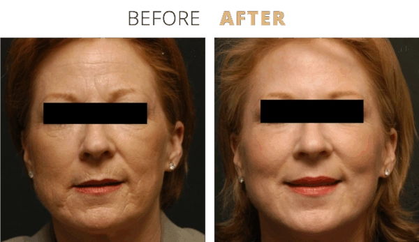 admin-ajax (5) - Edited