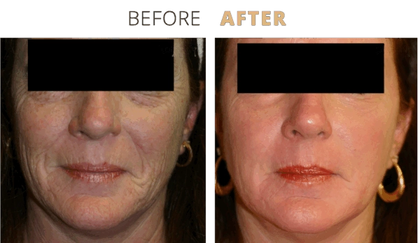 admin-ajax (7) - Edited