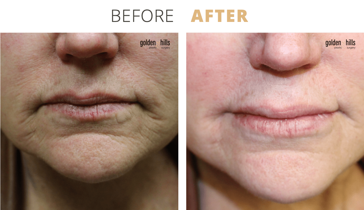 Injectables-Facial+Aging+Repair1