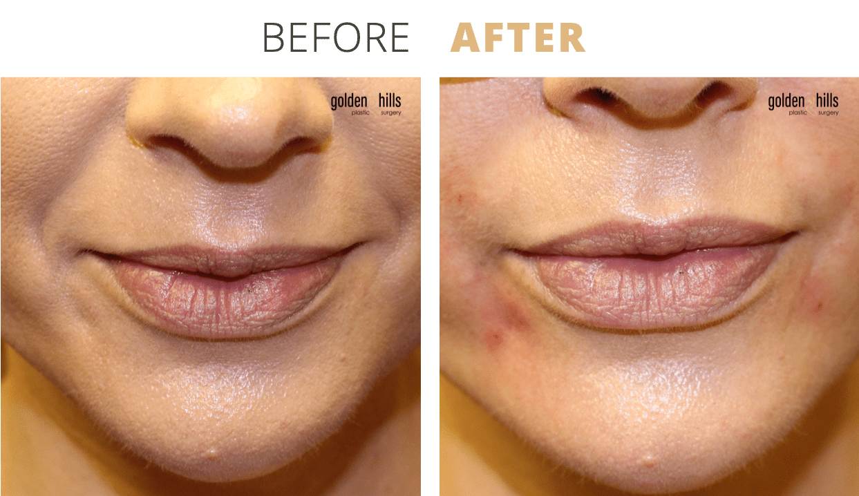 Injectables-Facial+Aging+Repair2