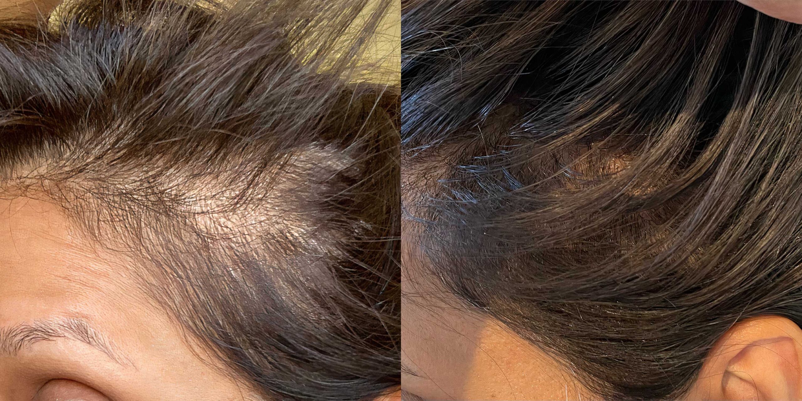 AnteAGE_HairB A_HMN HomeHair_4_HQ