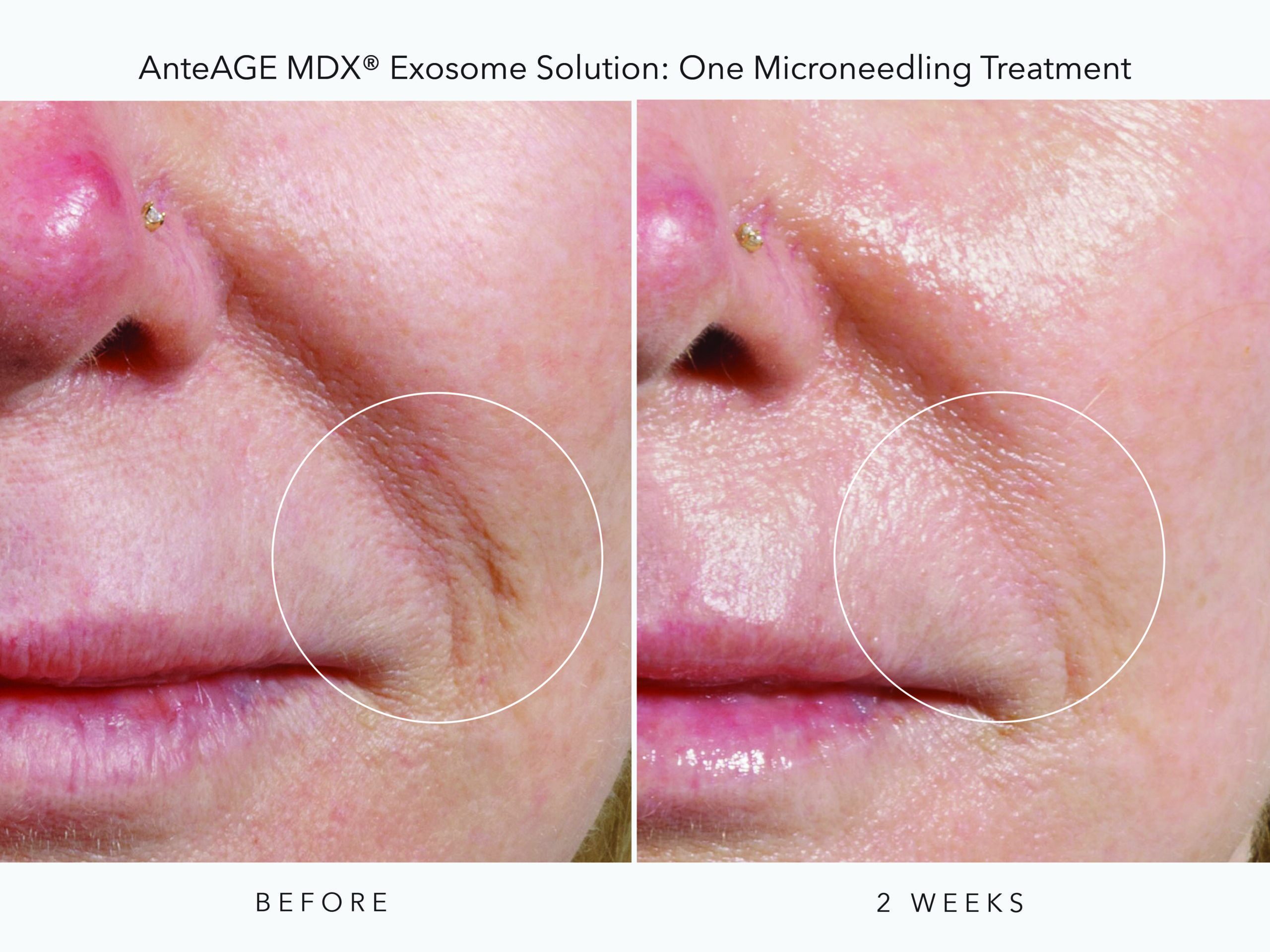 AnteAGE_MDX BA_2B_Digital