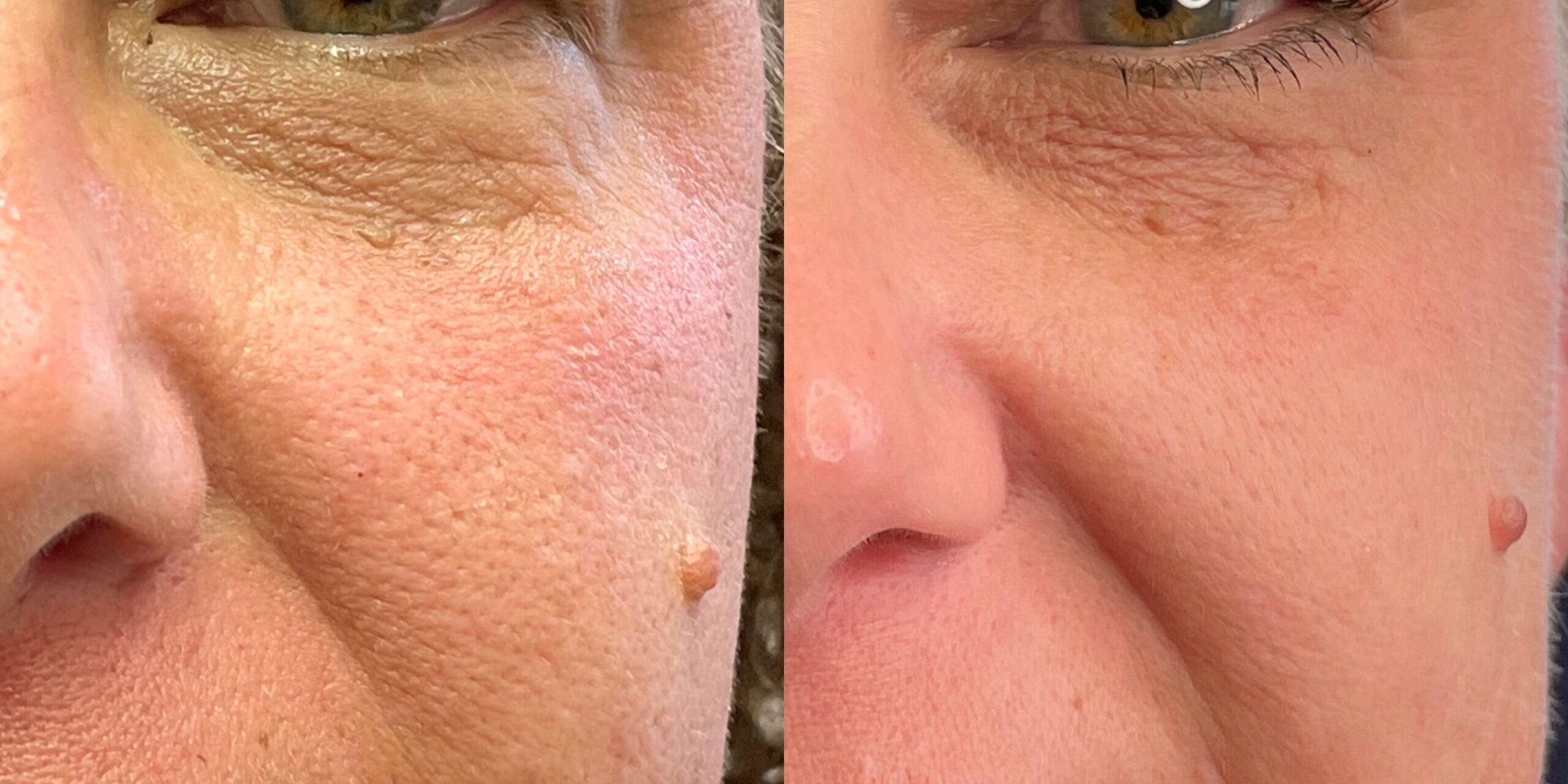 AnteAGE_SkinB A_FullRoutine_03A_HQ