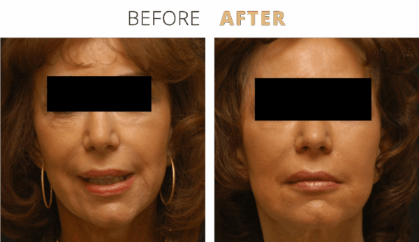 admin-ajax (4) - Edited