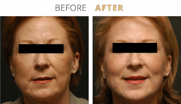 admin-ajax (5) - Edited