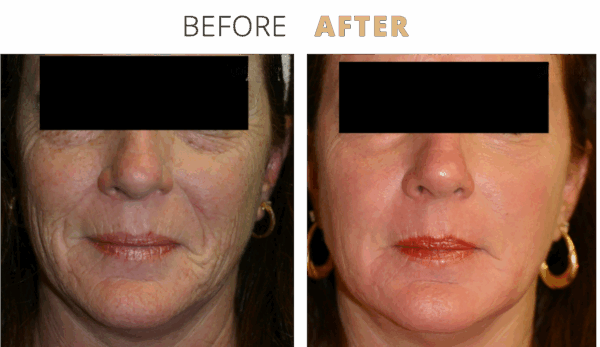 admin-ajax (7) - Edited