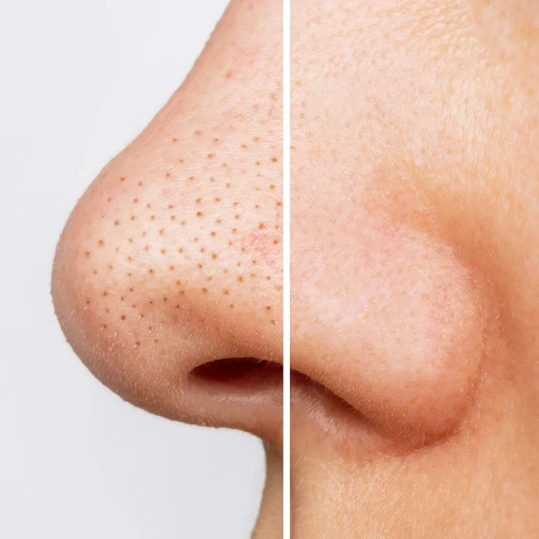 Pore-size-768x768
