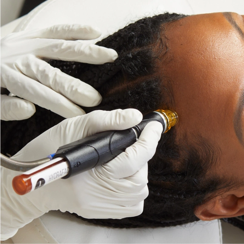 Scalp-img